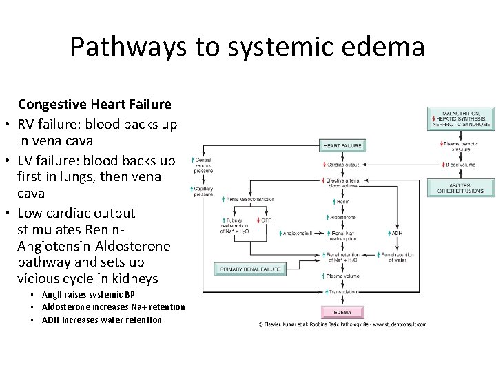 Pathways to systemic edema Congestive Heart Failure • RV failure: blood backs up in
