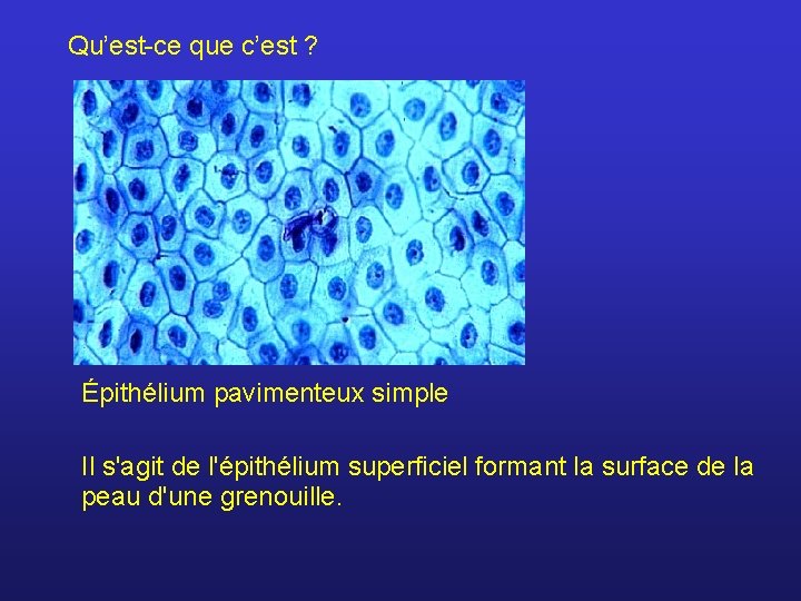 Qu’est-ce que c’est ? Épithélium pavimenteux simple Il s'agit de l'épithélium superficiel formant la