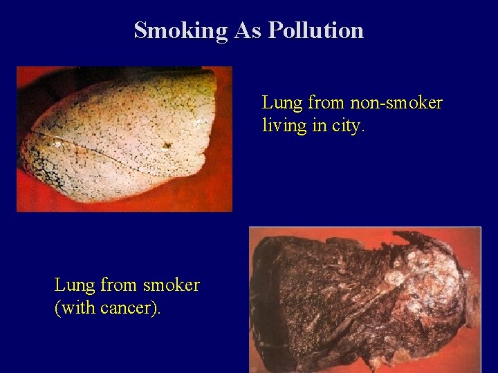 Smoking As Pollution Lung from non-smoker living in city. Lung from smoker (with cancer).