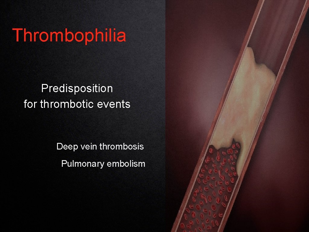 Thrombophilia Predisposition for thrombotic events Deep vein thrombosis Pulmonary embolism 