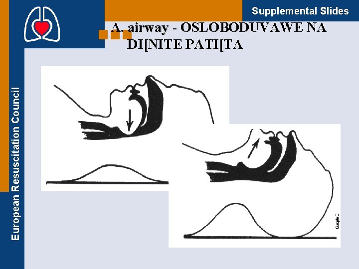 Supplemental Slides Campbell European Resuscitation Council А. airway - ОSLOBODUVAWE NA DI[NITE PATI[TA 
