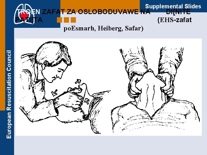 Supplemental Slides European Resuscitation Council TROEN ZAFAT ZA OSLOBODUVAWE NA PATI[TA po. Esmarh, Heiberg,