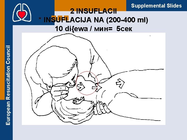 Supplemental Slides European Resuscitation Council 2 INSUFLACII * INSUFLACIJA NA (200 -400 ml) 10