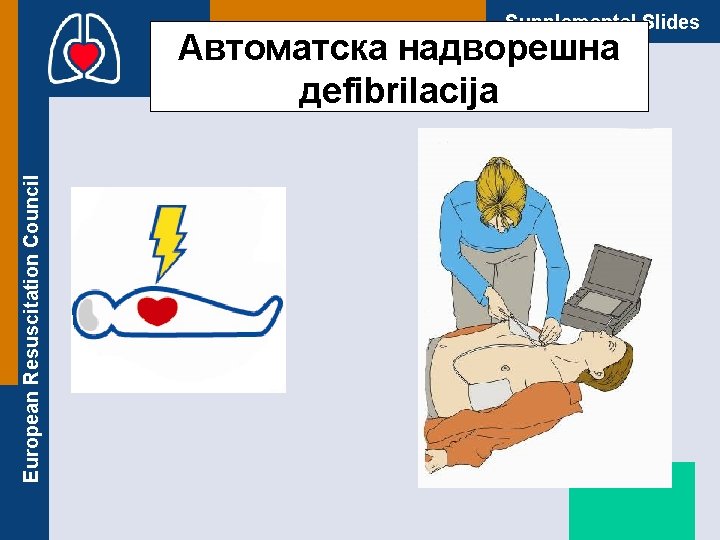 Supplemental Slides European Resuscitation Council Автоматска надворешна дefibrilacija 