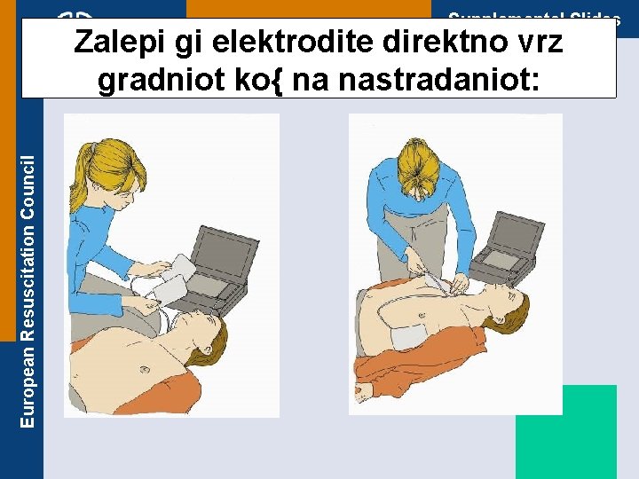 Supplemental Slides European Resuscitation Council Zalepi gi elektrodite direktno vrz gradniot ko{ na nastradaniot: