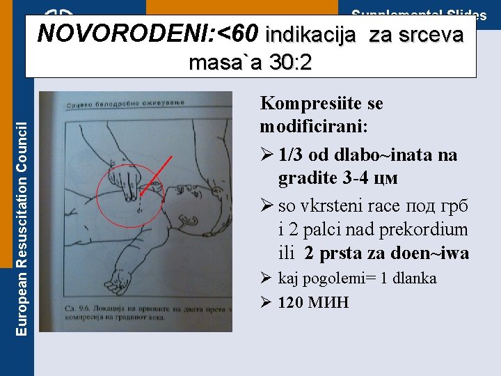 Supplemental Slides NOVORODENI: <60 indikacija za srceva European Resuscitation Council masa`a 30: 2 Kompresiite