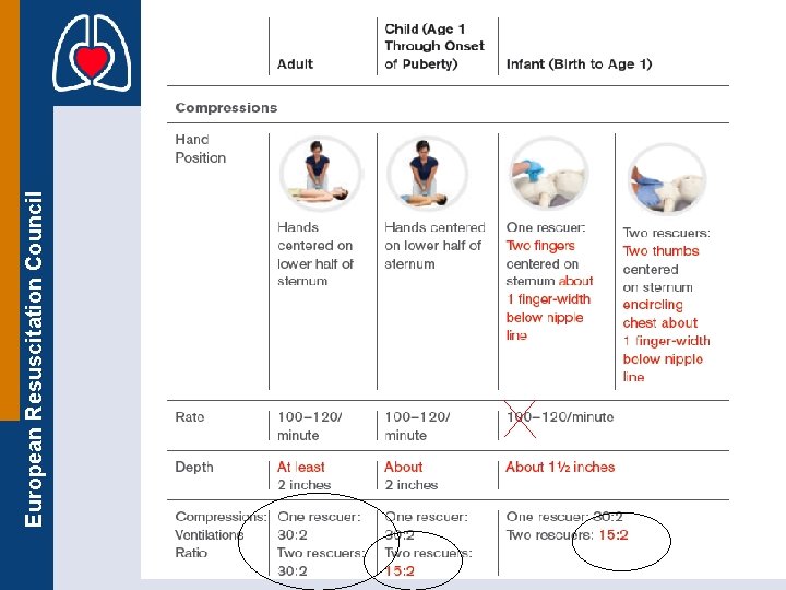 European Resuscitation Council Supplemental Slides 