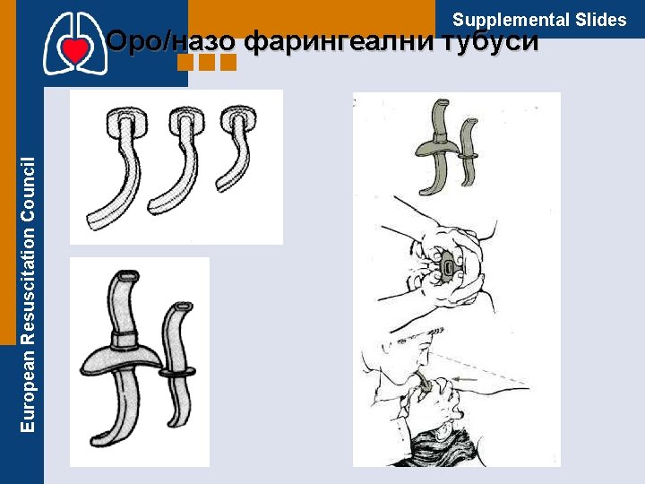 Supplemental Slides European Resuscitation Council Оро/назо фарингеални тубуси 
