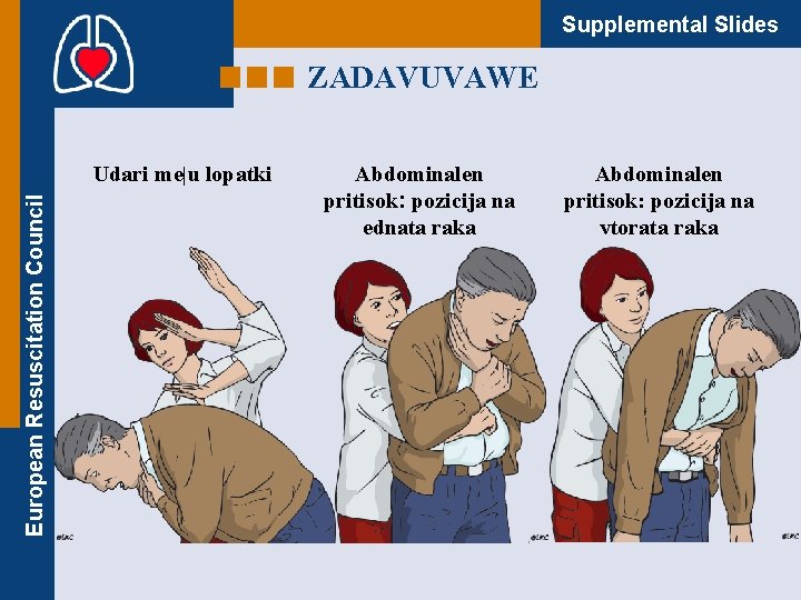 Supplemental Slides ZADAVUVAWE European Resuscitation Council Udari me|u lopatki Abdominalen pritisok: pozicija na ednata
