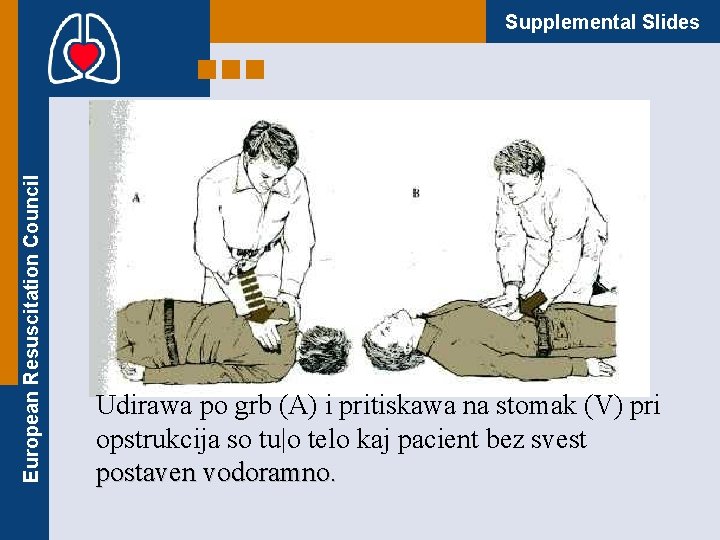 European Resuscitation Council Supplemental Slides Udirawa po grb (A) i pritiskawa na stomak (V)