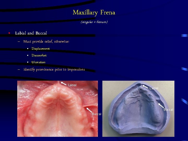 Maxillary Frena (singular = frenum) • Labial and Buccal – Must provide relief, otherwise: