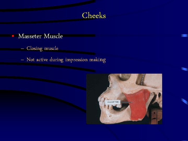 Cheeks • Masseter Muscle – Closing muscle – Not active during impression making Cheeks • Masseter Muscle – Closing muscle – Not active during impression making