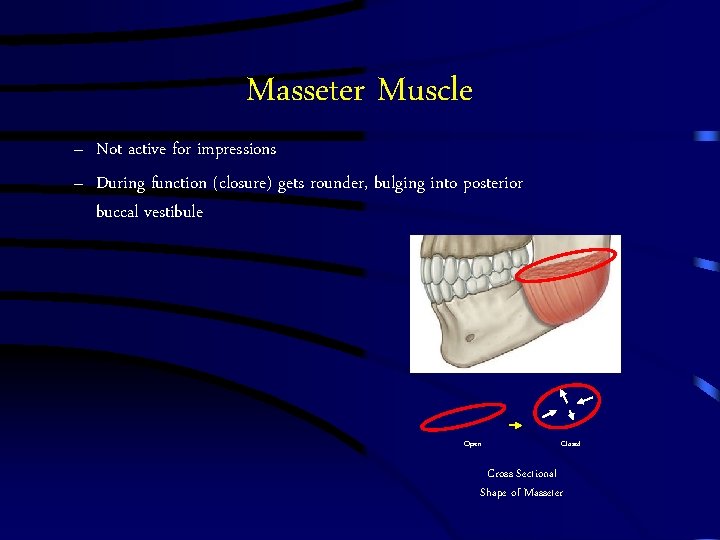 Masseter Muscle – Not active for impressions – During function (closure) gets rounder, bulging