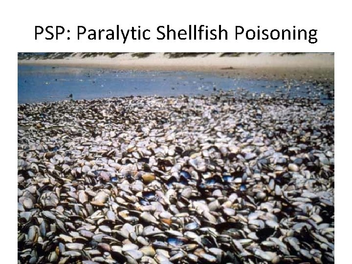 PSP: Paralytic Shellfish Poisoning 