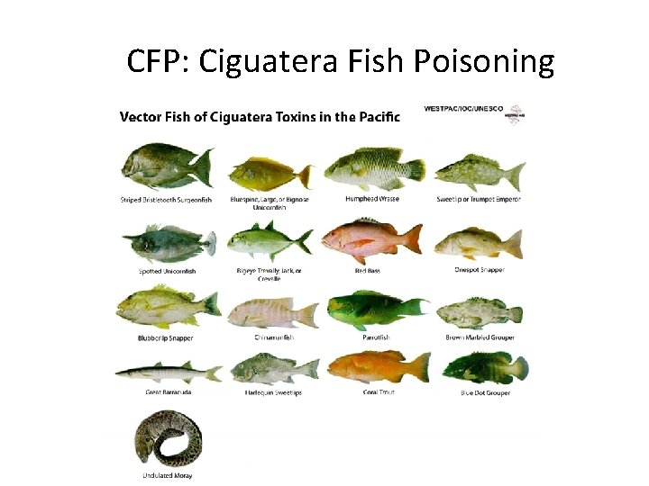 CFP: Ciguatera Fish Poisoning 