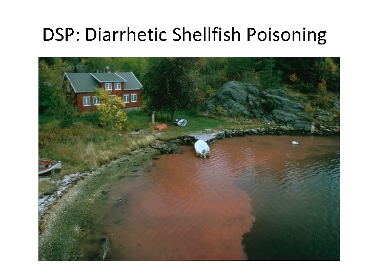 DSP: Diarrhetic Shellfish Poisoning 