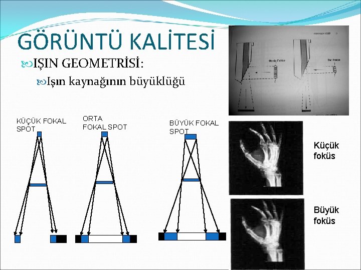 GÖRÜNTÜ KALİTESİ IŞIN GEOMETRİSİ: Işın kaynağının büyüklüğü KÜÇÜK FOKAL SPOT ORTA FOKAL SPOT BÜYÜK