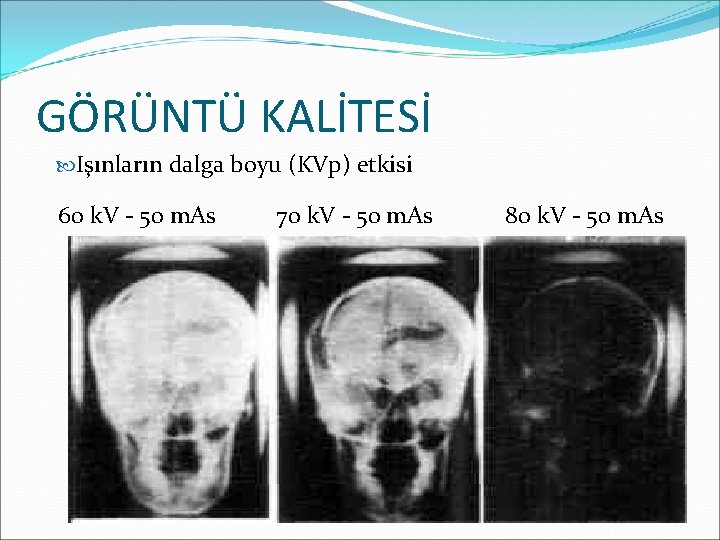 GÖRÜNTÜ KALİTESİ Işınların dalga boyu (KVp) etkisi 60 k. V - 50 m. As