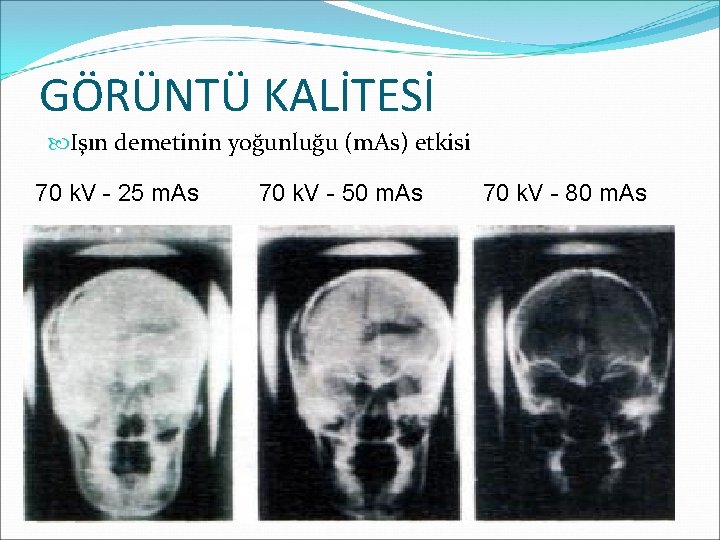 GÖRÜNTÜ KALİTESİ Işın demetinin yoğunluğu (m. As) etkisi 70 k. V - 25 m.