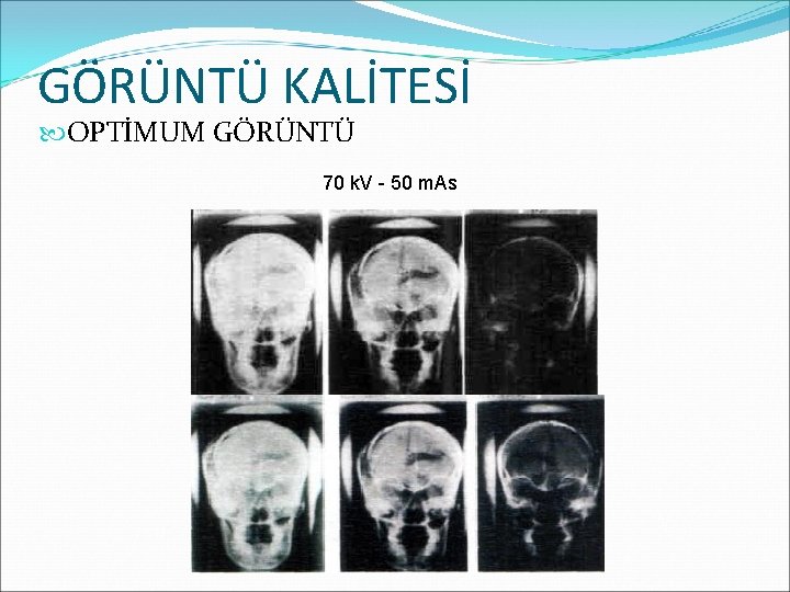 GÖRÜNTÜ KALİTESİ OPTİMUM GÖRÜNTÜ 70 k. V - 50 m. As 