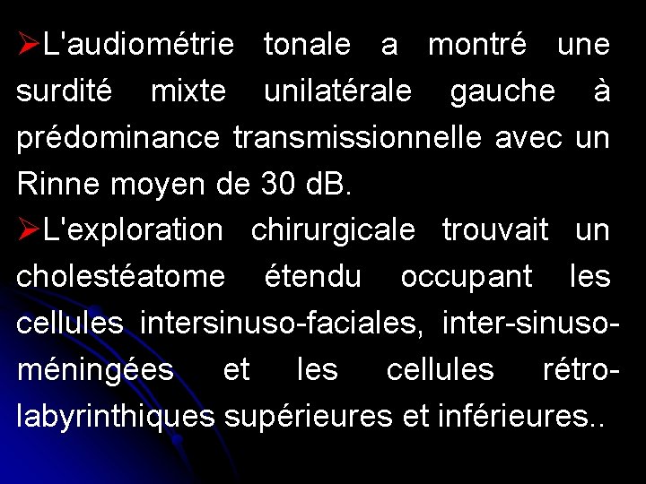 ØL'audiométrie tonale a montré une surdité mixte unilatérale gauche à prédominance transmissionnelle avec un