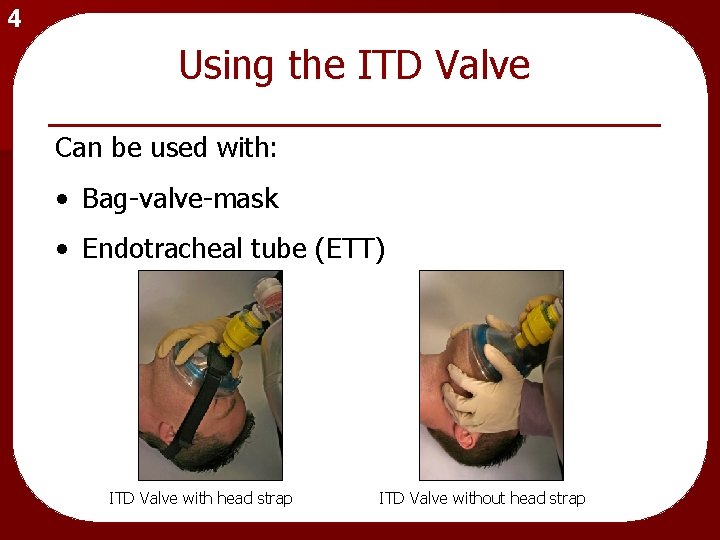 4 Using the ITD Valve Can be used with: • Bag-valve-mask • Endotracheal tube
