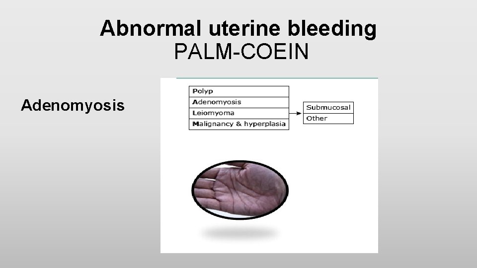 Abnormal uterine bleeding PALM-COEIN Adenomyosis 