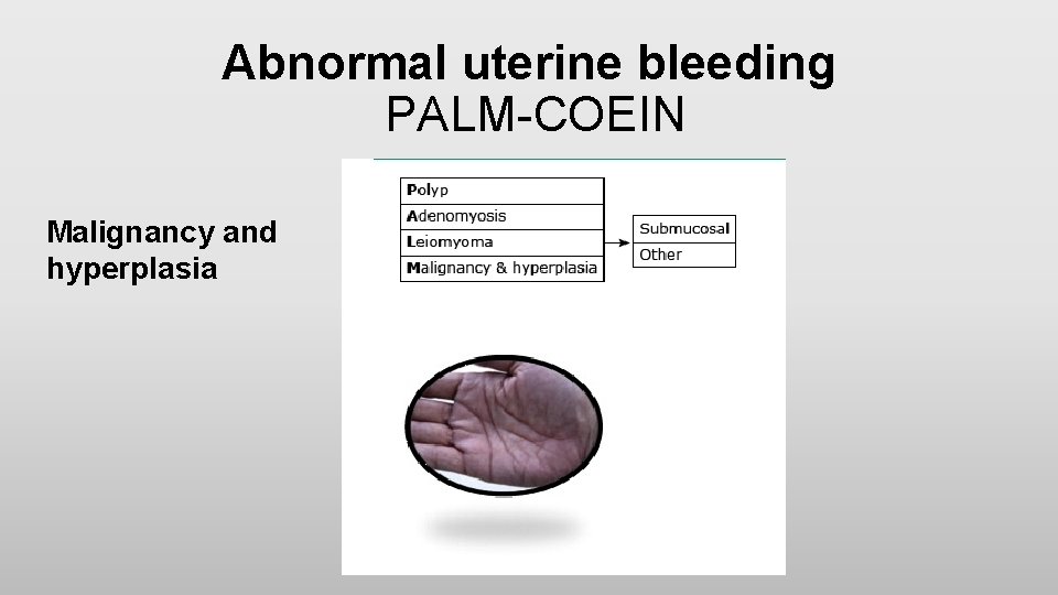 Abnormal uterine bleeding PALM-COEIN Malignancy and hyperplasia 