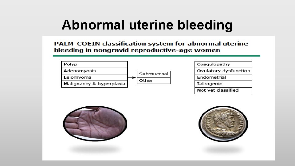 Abnormal uterine bleeding 