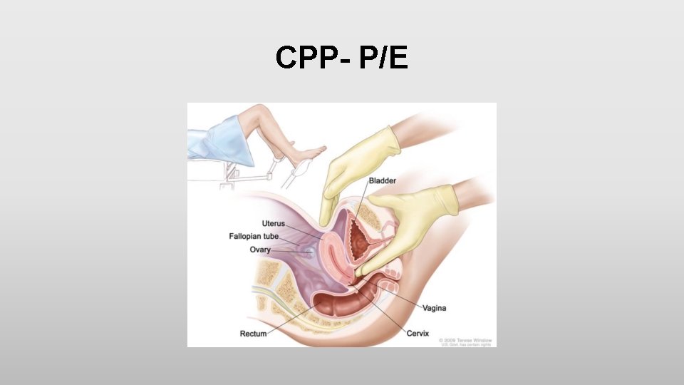 CPP- P/E 