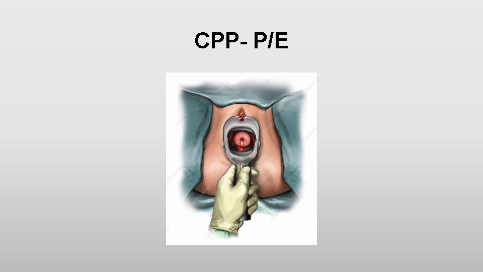 CPP- P/E 