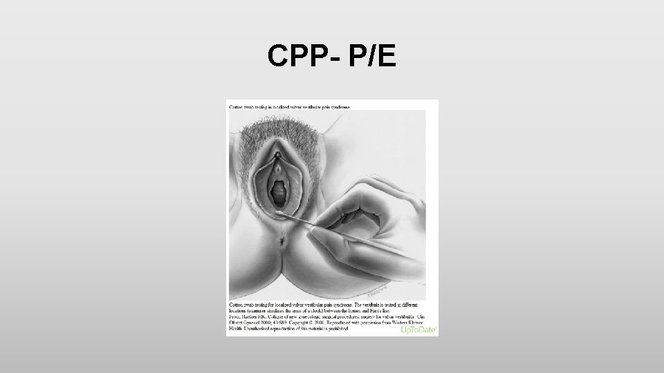 CPP- P/E 