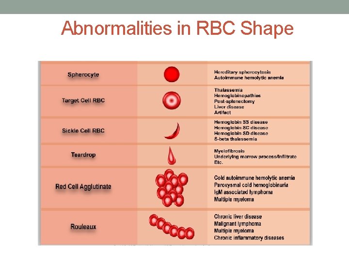 Abnormalities in RBC Shape  Abnormalities in RBC Shape