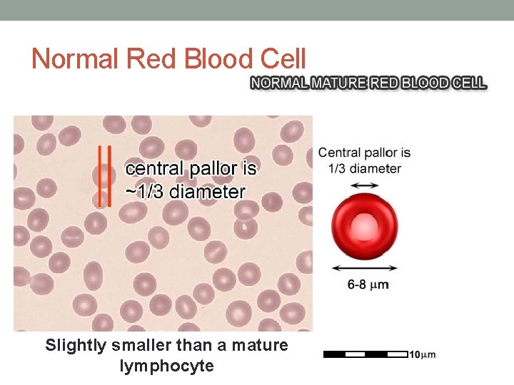 Normal Red Blood Cell Slightly smaller than a mature lymphocyte  Normal Red Blood Cell Slightly smaller than a mature lymphocyte