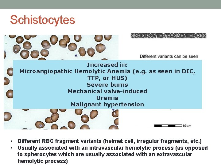 Schistocytes Increased in: Microangiopathic Hemolytic Anemia (e. g. as seen in DIC, TTP, or Schistocytes Increased in: Microangiopathic Hemolytic Anemia (e. g. as seen in DIC, TTP, or