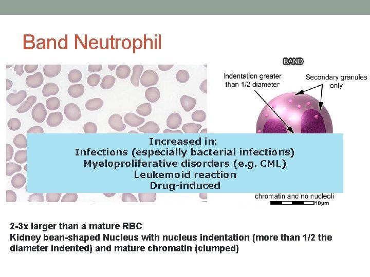 Band Neutrophil Increased in: Infections (especially bacterial infections) Myeloproliferative disorders (e. g. CML) Leukemoid Band Neutrophil Increased in: Infections (especially bacterial infections) Myeloproliferative disorders (e. g. CML) Leukemoid