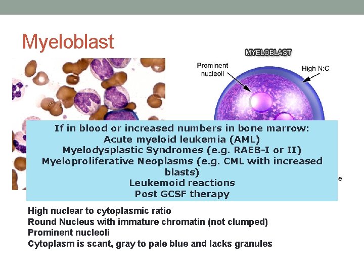 Myeloblast If in blood or increased numbers in bone marrow: Acute myeloid leukemia (AML) Myeloblast If in blood or increased numbers in bone marrow: Acute myeloid leukemia (AML)