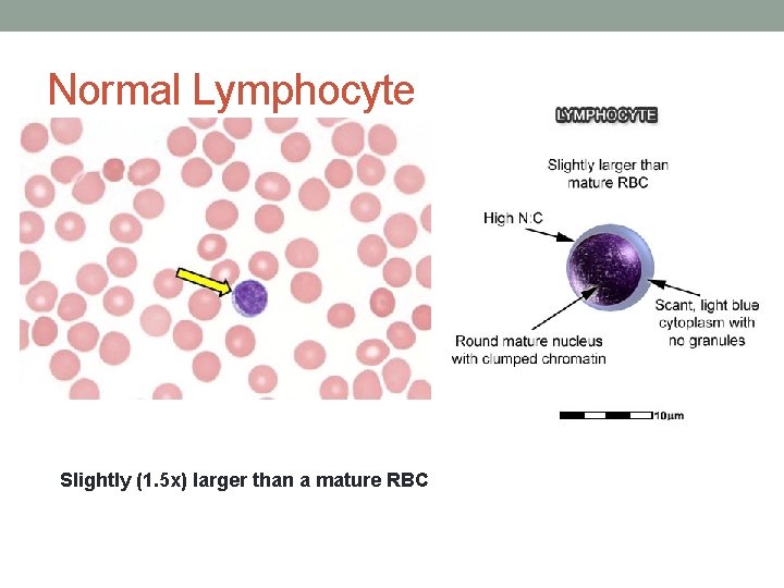 Normal Lymphocyte Slightly (1. 5 x) larger than a mature RBC  Normal Lymphocyte Slightly (1. 5 x) larger than a mature RBC