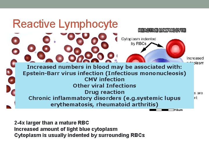 Reactive Lymphocyte Increased numbers in blood may be associated with: Epstein-Barr virus infection (Infectious Reactive Lymphocyte Increased numbers in blood may be associated with: Epstein-Barr virus infection (Infectious
