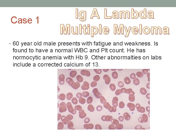 Case 1 Ig A Lambda Multiple Myeloma • 60 year old male presents with Case 1 Ig A Lambda Multiple Myeloma • 60 year old male presents with