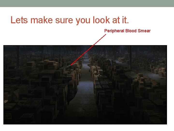 Lets make sure you look at it. Peripheral Blood Smear  Lets make sure you look at it. Peripheral Blood Smear