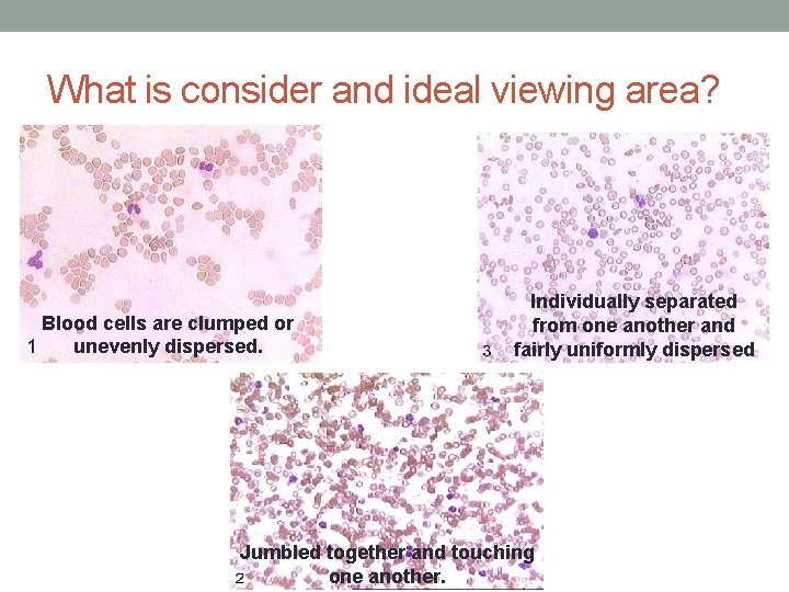What is consider and ideal viewing area? Blood cells are clumped or unevenly dispersed. What is consider and ideal viewing area? Blood cells are clumped or unevenly dispersed.