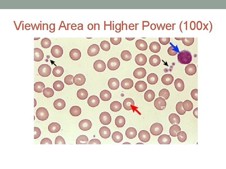 Viewing Area on Higher Power (100 x)  Viewing Area on Higher Power (100 x)