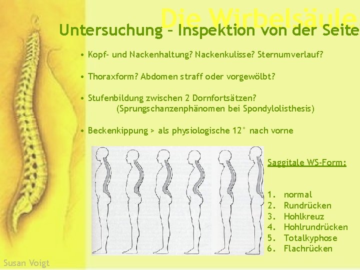 Die Wirbelsäule Untersuchung – Inspektion von der Seite • Kopf- und Nackenhaltung? Nackenkulisse? Sternumverlauf?