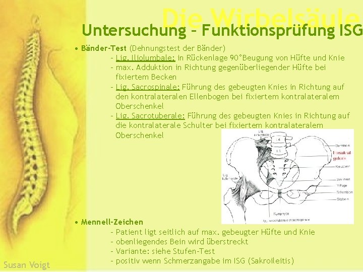 Die Wirbelsäule Untersuchung – Funktionsprüfung ISG • Bänder-Test (Dehnungstest der Bänder) - Lig. Iliolumbale: