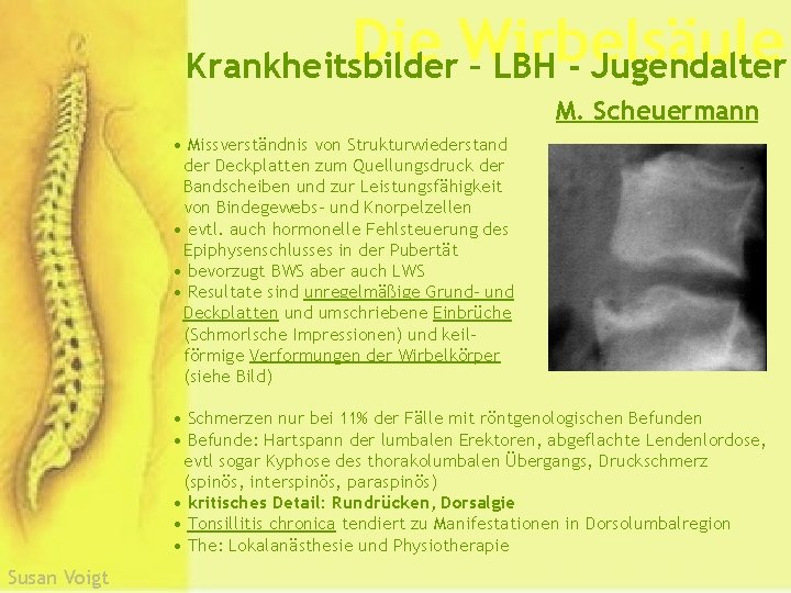 Die Wirbelsäule Krankheitsbilder – LBH - Jugendalter M. Scheuermann • Missverständnis von Strukturwiederstand der