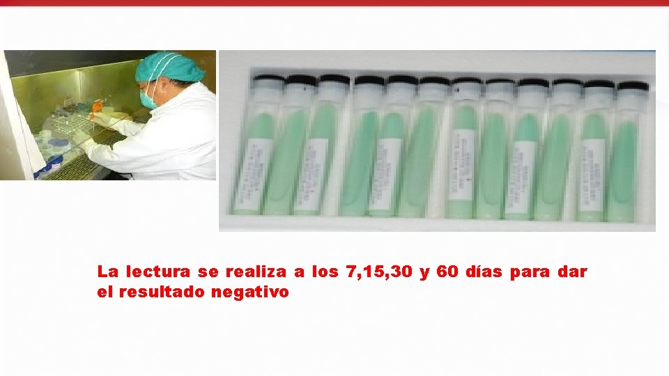 La lectura se realiza a los 7, 15, 30 y 60 días para dar