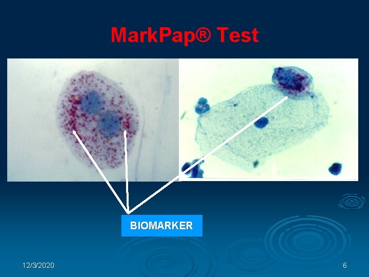 Mark. Pap® Test BIOMARKER 12/3/2020 6 