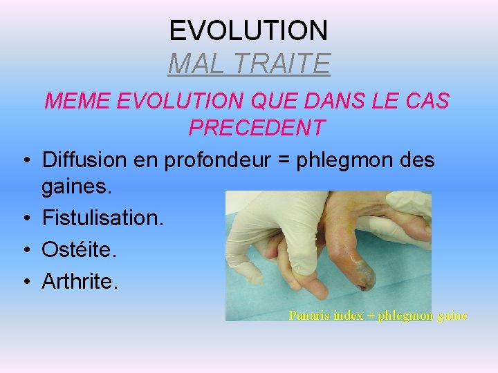EVOLUTION MAL TRAITE • • MEME EVOLUTION QUE DANS LE CAS PRECEDENT Diffusion en