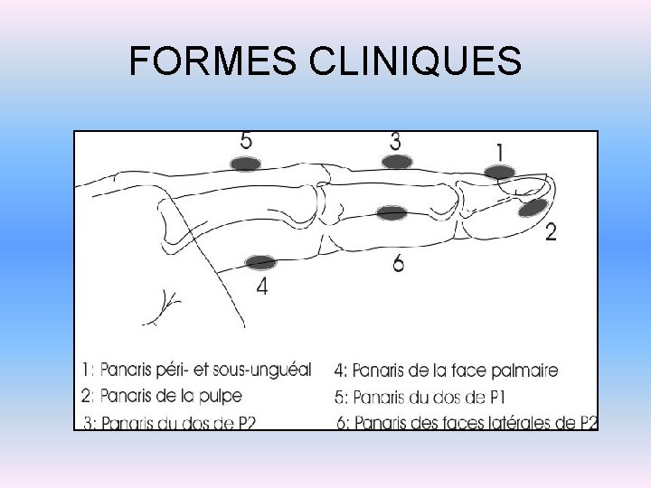 FORMES CLINIQUES 